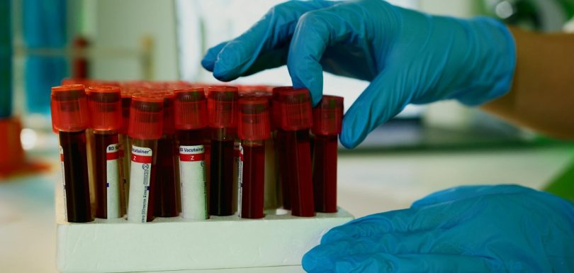 Accelerating Clinical Trials with Advanced Analytics and Visualization