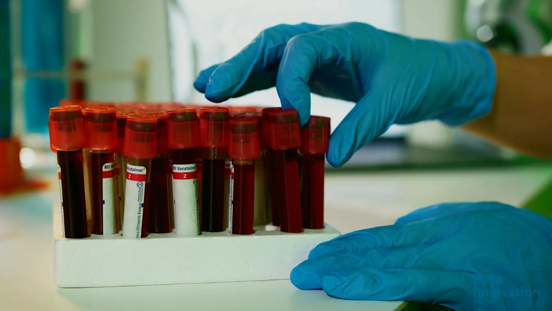 Accelerating Clinical Trials with Advanced Analytics and Visualization
