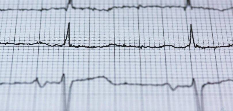 Orquestación omnicanal impulsa el rendimiento ante pérdida de señal y fragmentación